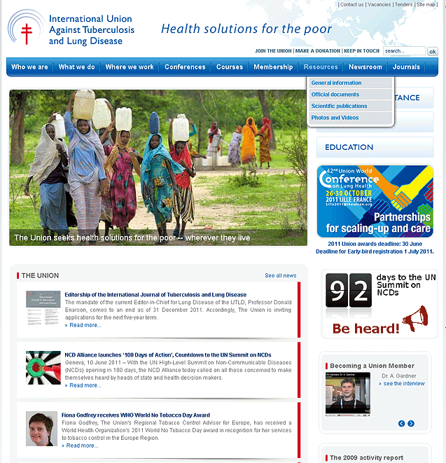 Template & développement Joomla : the union